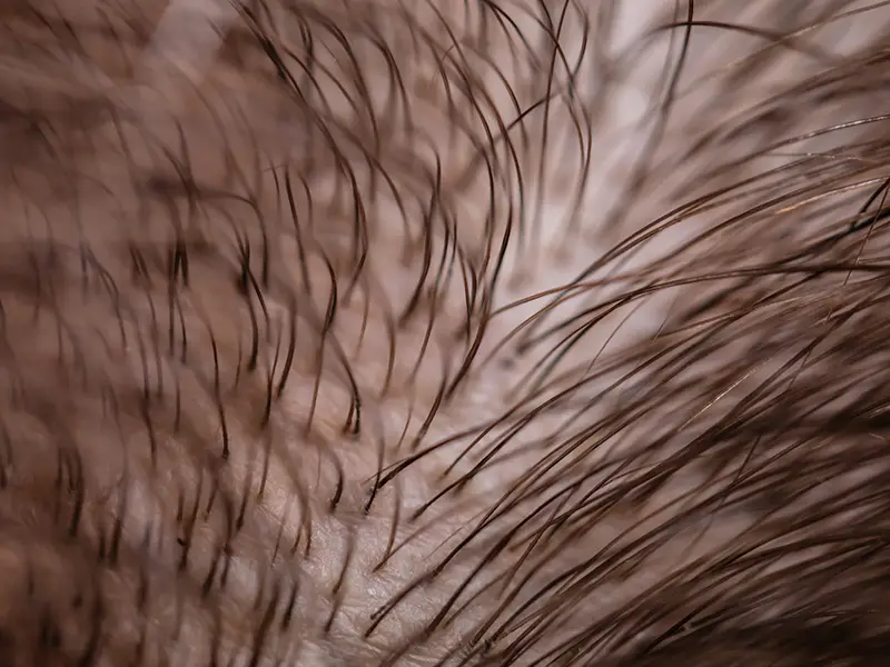 Anti-inflammatory Mechanism for Scalp