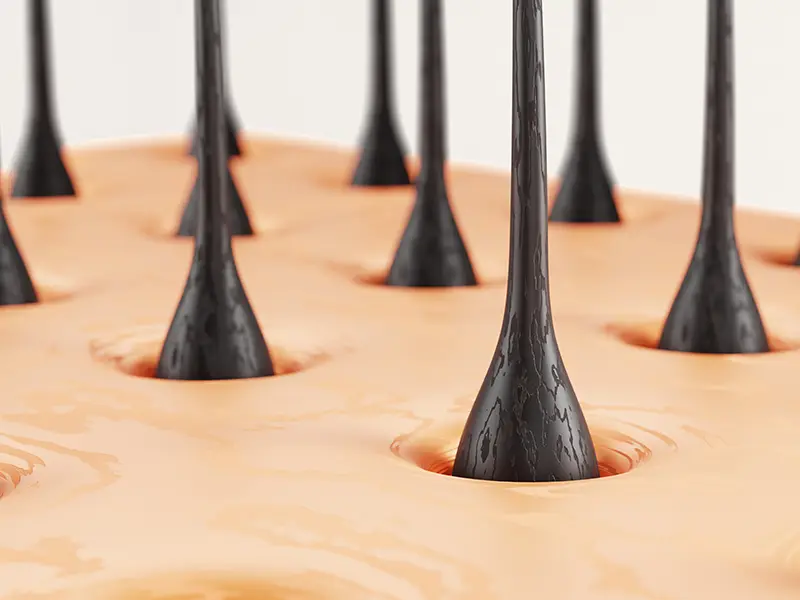 FUE Hair Transplant - TIME Anti-Aging and Hair Transplant Center