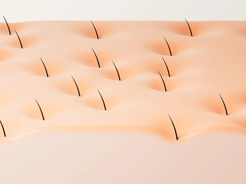 Graft Survival Optimization