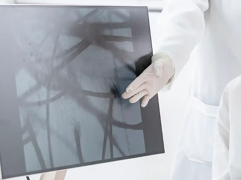Scalp Analysis - TIME Anti-Aging and Hair Transplant Center