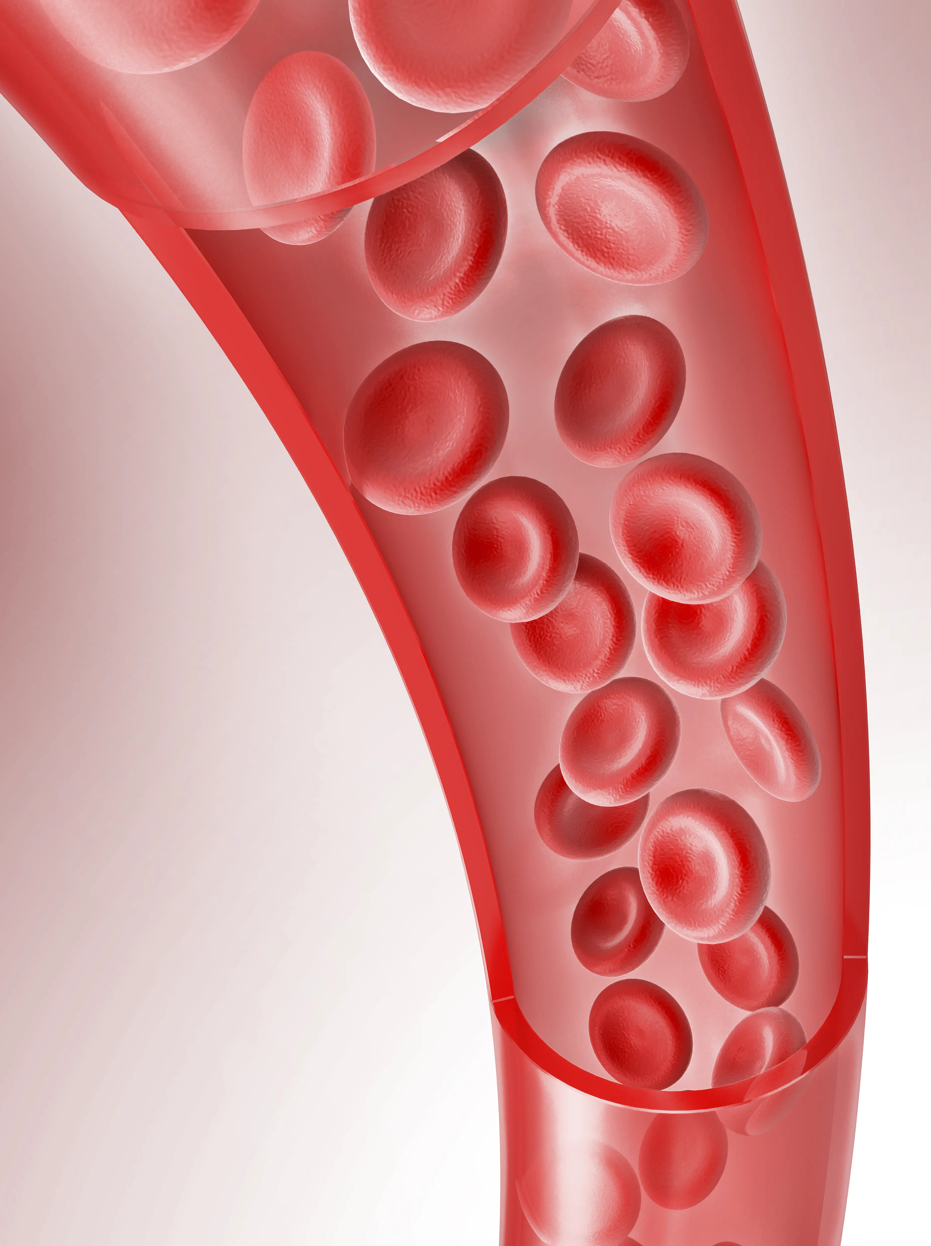 PRP Therapy 결과