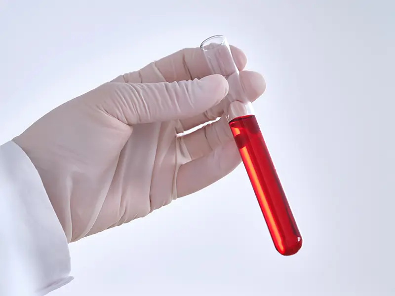 PRP Platelet Concentration Process