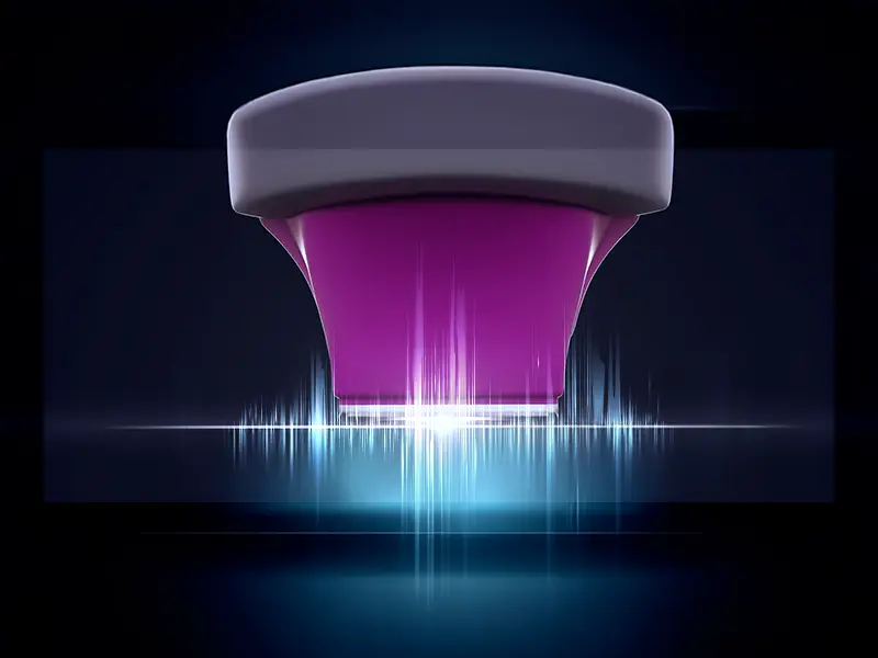 Comfort Pulse Technology - Thermage FLX